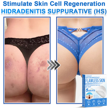 ⭐ Celsiora® 2-in-1 Microneedle & Hydrocolloid Patch | Raised Moles,Acne,  Flat Warts & Skin Tags Remover | Improves Wrinkles, Scars & Blemishes | Invisible Pimple Patches for Face & Body