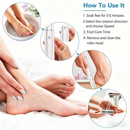 🌿Portable Electric Feet Callus Remover